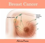 Breast Cancer (eBook, PDF) Breast Cancer (eBook, PDF)