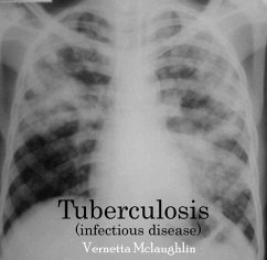 Tuberculosis(infectious disease) (eBook, PDF) - Mclaughlin, Vernetta Tuberculosis(infectious disease) (eBook, PDF) - Mclaughlin, Vernetta