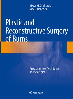 Plastic and Reconstructive Surgery of Burns (eBook, PDF) - Grishkevich, Viktor M.; Grishkevich, Max