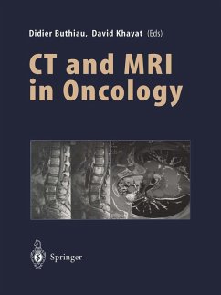 Cover CT and MRI in Oncology (eBook, PDF)