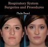 Respiratory System Surgeries and... - Bild 1