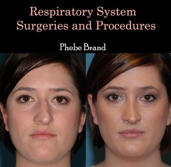 Respiratory System Surgeries and Procedures (eBook, PDF)
