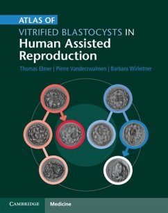 Cover Atlas of Vitrified Blastocysts in Human Assisted Reproduction (eBook, PDF)