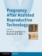 Pregnancy After Assisted Reproductive... - Bild 1