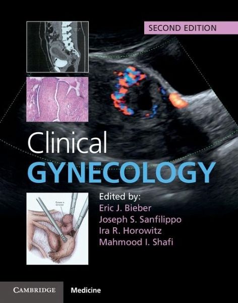 Clinical Gynecology (eBook, ePUB) Clinical Gynecology (eBook, ePUB)