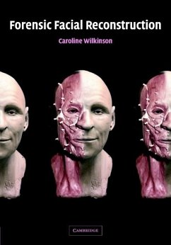 Forensic Facial Reconstruction (eBook, ePUB) - Wilkinson, Caroline