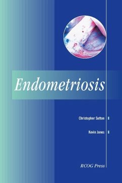 Endometriosis (eBook, ePUB) - Sutton, Christopher