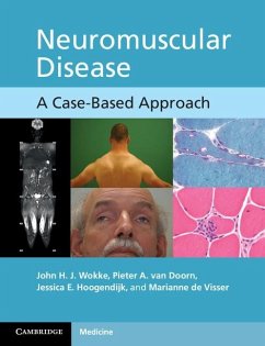 Neuromuscular Disease (eBook, ePUB) - Wokke, John H. J.