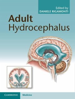 Adult Hydrocephalus (eBook, ePUB)