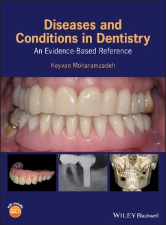 Diseases and Conditions in Dentistry (eBook, PDF) - Moharamzadeh, Keyvan