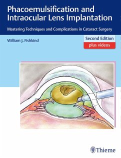 Phacoemulsification and Intraocular Lens Implantation (eBook, PDF) - Fishkind, William J.