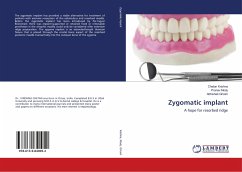 Zygomatic implant