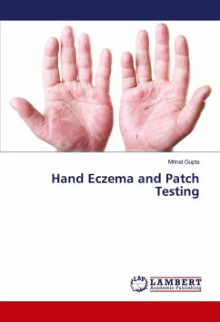 Hand Eczema and Patch Testing - Gupta, Mrinal
