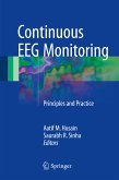Continuous EEG Monitoring (eBook, PDF)