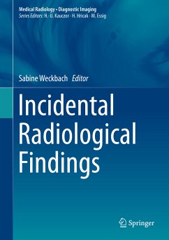 Incidental Radiological Findings (eBook, PDF)