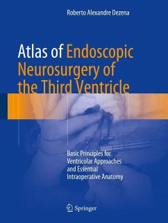 Atlas of Endoscopic Neurosurgery of the Third Ventricle (eBook, PDF) - Dezena, Roberto Alexandre