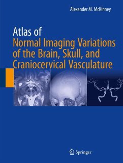 Atlas of Normal Imaging Variations of the Brain, Skull, and Craniocervical Vasculature (eBook, PDF) - McKinney, Alexander M.