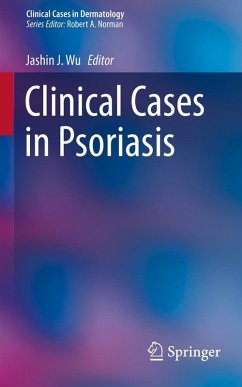 Cover Clinical Cases in Psoriasis (eBook, PDF)