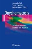 Onychomycosis (eBook, PDF)