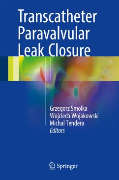 Transcatheter Paravalvular Leak Closure (eBook, PDF)