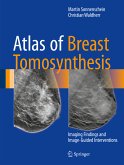 Atlas of Breast Tomosynthesis (eBook, PDF)