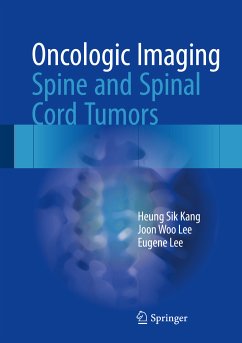 Oncologic Imaging: Spine and Spinal Cord Tumors (eBook, PDF) - Kang, Heung Sik; Lee, Joon Woo; Lee, Eugene
