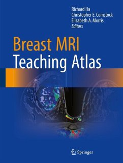 Cover Breast MRI Teaching Atlas (eBook, PDF)