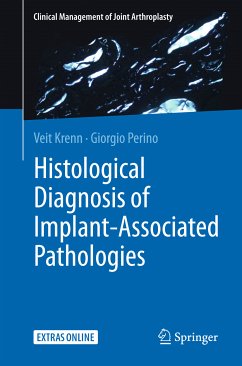 Histological Diagnosis of Implant-associated Pathologies (eBook, PDF) - Krenn, Veit; Perino, Giorgio