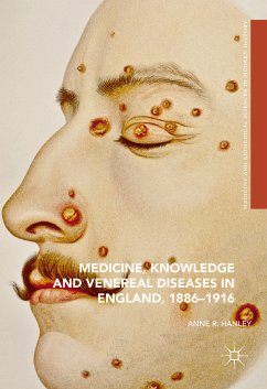 Medicine, Knowledge and Venereal Diseases in England, 1886-1916 (eBook, PDF) - Hanley, Anne R.