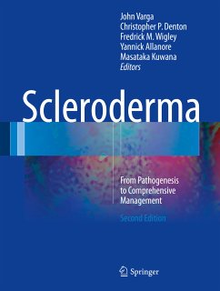 Scleroderma (eBook, PDF)
