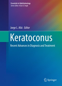 Keratoconus (eBook, PDF)