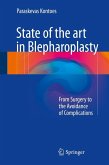 State of the art in Blepharoplasty (eBook, PDF)