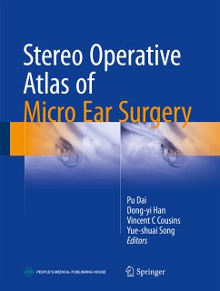 Stereo Operative Atlas of Micro Ear Surgery (eBook, PDF)