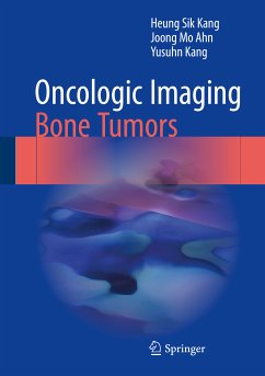 Oncologic Imaging: Bone Tumors (eBook, PDF) - Kang, Heung Sik; Ahn, Joong Mo; Kang, Yusuhn