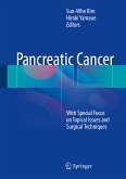 Pancreatic Cancer (eBook, PDF)