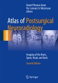 Atlas of Postsurgical Neuroradiology (eBook, PDF)