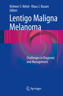 Lentigo Maligna Melanoma (eBook, PDF)