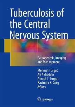 Tuberculosis of the Central Nervous System (eBook, PDF)