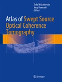 Atlas of Swept Source Optical Coherence Tomography (eBook, PDF)