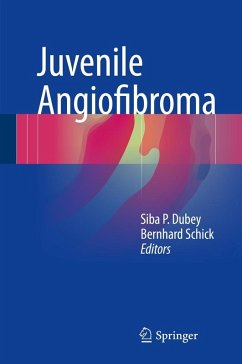 Juvenile Angiofibroma (eBook, PDF) Juvenile Angiofibroma (eBook, PDF)