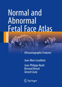 Normal and Abnormal Fetal Face Atlas (eBook, PDF) - Levaillant, Jean-Marc; Bault, Jean-Philippe; Benoit, Bernard; Couly, Gérard