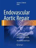 Endovascular Aortic Repair (eBook, PDF)