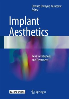 Cover Implant Aesthetics (eBook, PDF)