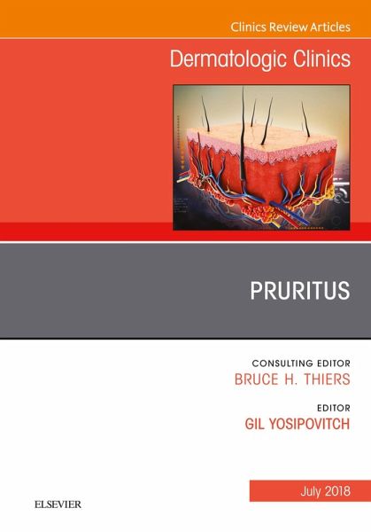 Pruritus, An Issue of Dermatologic Clinics (eBook, ePUB) Pruritus, An Issue of Dermatologic Clinics (eBook, ePUB)