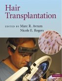 Hair Transplantation (eBook, ePUB)