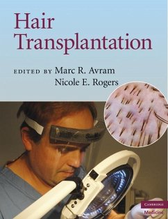 Hair Transplantation (eBook, ePUB) - Avram, Marc R.