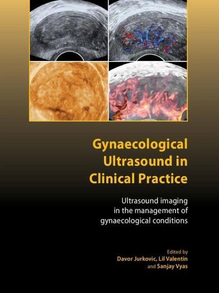 Gynaecological Ultrasound in Clinical Practice (eBook, ePUB) Gynaecological Ultrasound in Clinical Practice (eBook, ePUB)