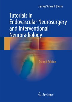 Tutorials in Endovascular Neurosurgery and Interventional Neuroradiology (eBook, PDF) - Byrne, James Vincent