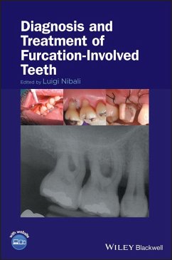 Cover Diagnosis and Treatment of Furcation-Involved Teeth (eBook, ePUB)
