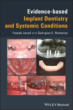 Evidence-based Implant Dentistry and Systemic Conditions (eBook, PDF) - Javed, Fawad; Romanos, Georgios E.